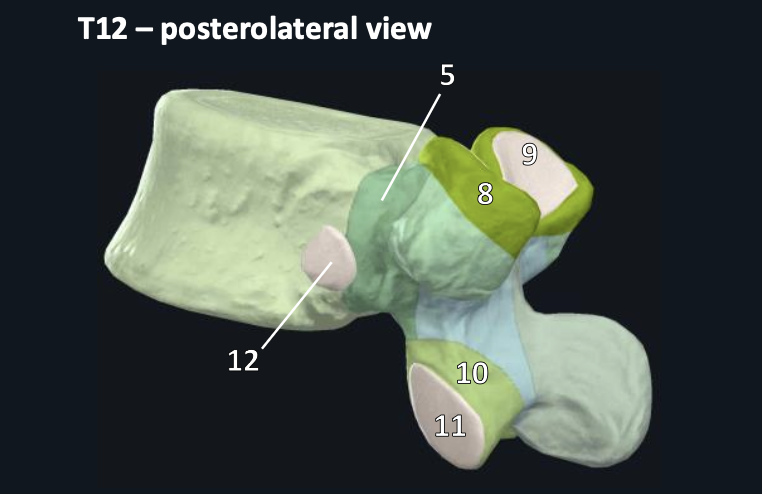 <p>structure #10</p>