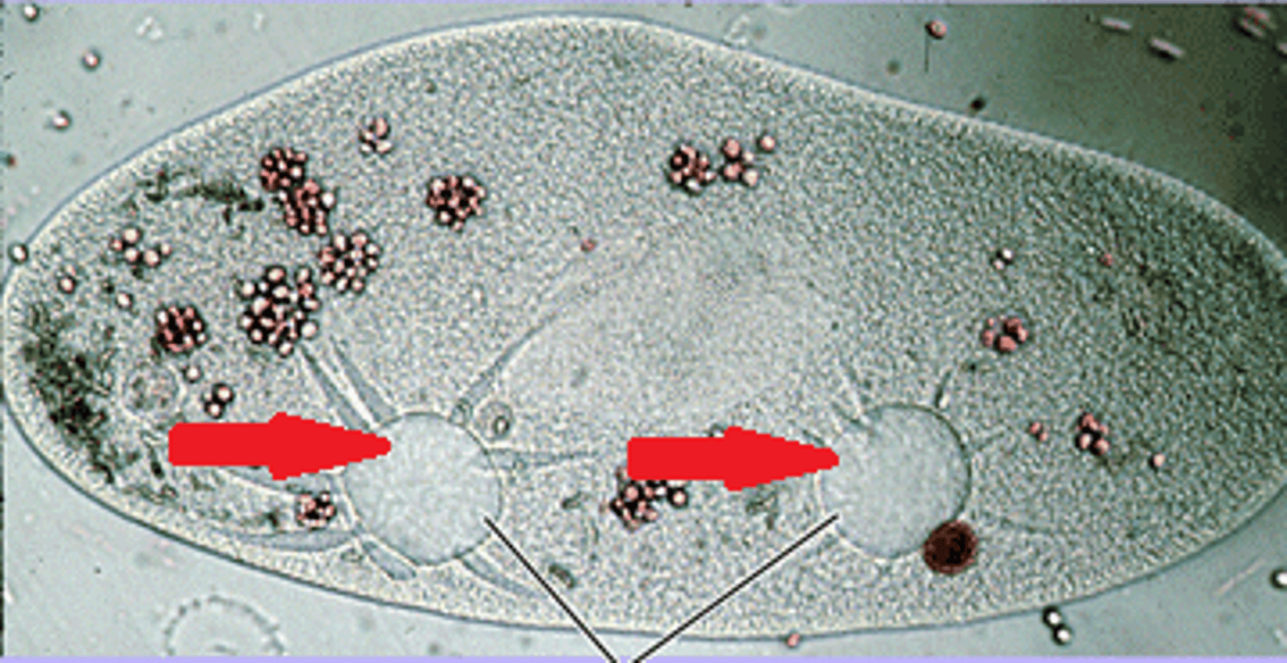 <p>A membranous sac that helps move excess water out of the cell.</p>