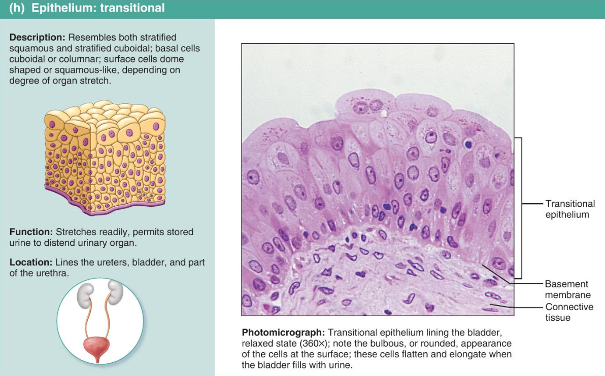 <p>Transitional Epithelium</p>