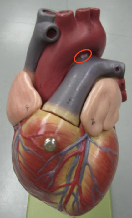 <p>In between aortic arch and pulmonary trunk, small pink thing</p>