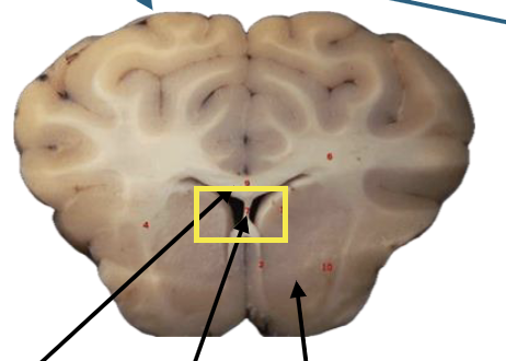 <p>What is this highlighted figure?</p>