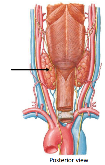 <p>What is the arrow pointing too? </p>