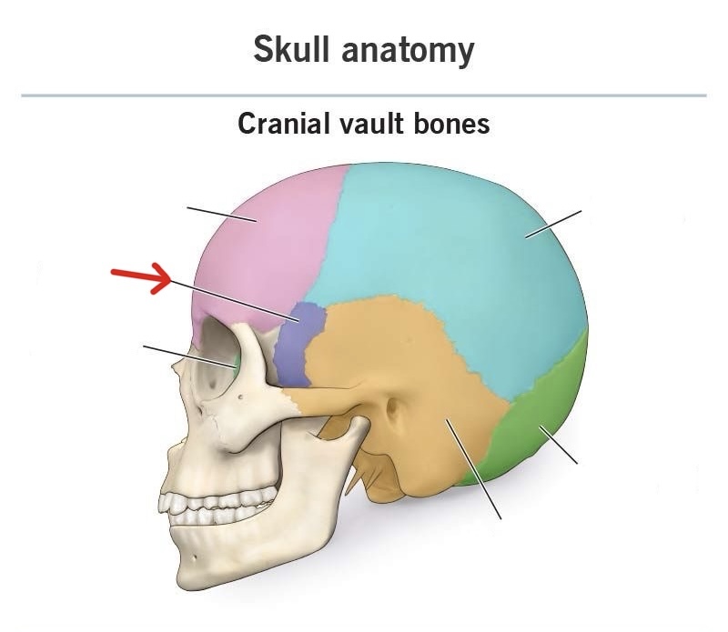 term image