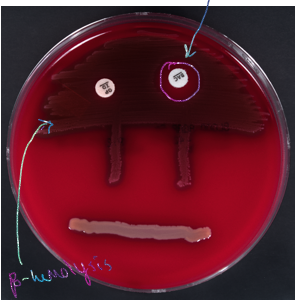 <ul><li><p>beta-hemolysis (yellow)</p></li><li><p>group A strep</p></li><li><p>bacitracin sensitivity</p></li></ul><p></p>