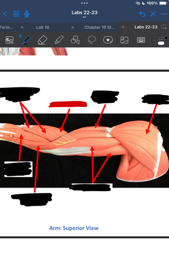 <p>What muscle is this?</p>