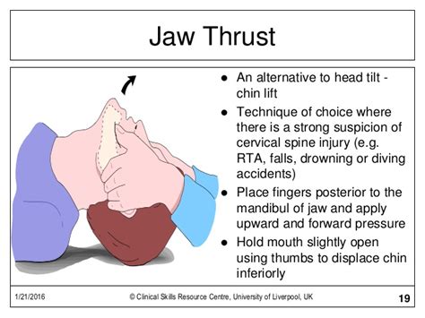 <p>use when you suspect neck injury</p>