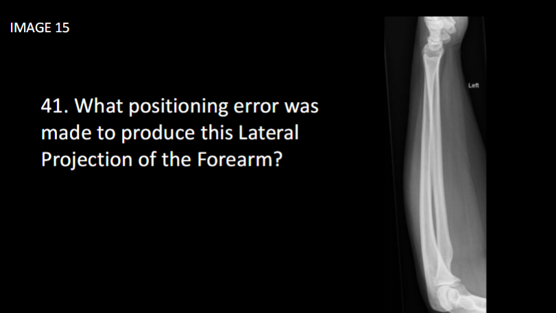 <p><span>What positioning error was made to produce this Lateral Projection of the Forearm?</span></p>