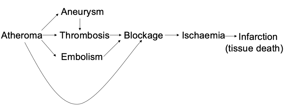 <p><span>•</span><span style="font-family: &quot;Times New Roman&quot;; line-height: normal; font-size: 7pt;">&nbsp;&nbsp;&nbsp;&nbsp;&nbsp;&nbsp; </span>characterised by the deposition of fibrous growths (plaques) within the walls of arteries, narrowing them</p><p class="MsoListParagraphCxSpMiddle"><span>•</span><span style="font-family: &quot;Times New Roman&quot;; line-height: normal; font-size: 7pt;">&nbsp;&nbsp;&nbsp;&nbsp;&nbsp;&nbsp; </span>Consequences of atheroma:</p><p class="MsoListParagraphCxSpMiddle"><span>o</span><span style="font-family: &quot;Times New Roman&quot;; line-height: normal; font-size: 7pt;">&nbsp;&nbsp; </span>Smaller vessels may become blocked</p><p class="MsoListParagraphCxSpMiddle"><span>o</span><span style="font-family: &quot;Times New Roman&quot;; line-height: normal; font-size: 7pt;">&nbsp;&nbsp; </span>Plaques may become the site of a thrombosis (blood clot forming over the atheroma part)</p><p class="MsoListParagraphCxSpMiddle"><span>o</span><span style="font-family: &quot;Times New Roman&quot;; line-height: normal; font-size: 7pt;">&nbsp;&nbsp; </span>A piece of plaque becomes detached from an atheroma and form an embolism – other things such as fat, bits of tumour or air bubbles can form emboli.</p><p class="MsoListParagraphCxSpMiddle"><span>o</span><span style="font-family: &quot;Times New Roman&quot;; line-height: normal; font-size: 7pt;">&nbsp;&nbsp; </span>A plaque can be the site of an aneurysm – common in the brain, can be clipped or filled with endovascular platinum coils under direct x-ray visualisation (seal off balloon so it doesn’t burst).</p><p class="MsoListParagraphCxSpLast"><span>o</span><span style="font-family: &quot;Times New Roman&quot;; line-height: normal; font-size: 7pt;">&nbsp;&nbsp; </span>Aneurysms are often the site of thrombosis</p><p class="MsoListParagraphCxSpLast"></p>