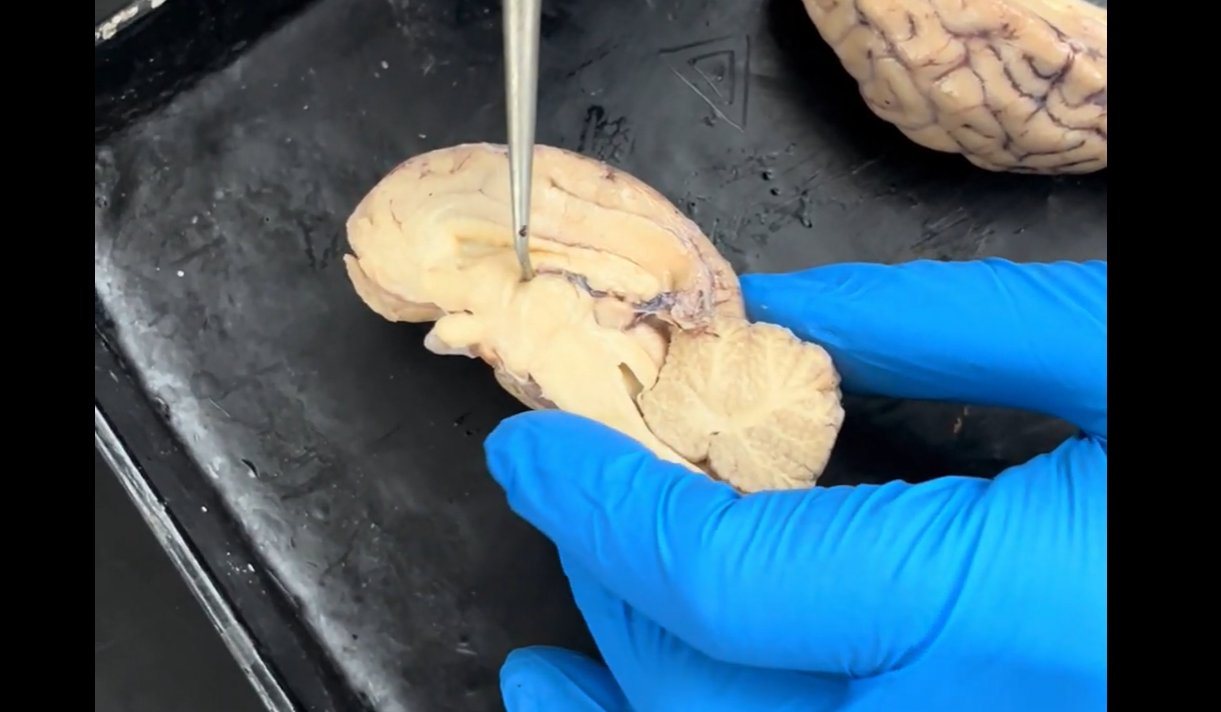 <p>Name the groove that the tip of the probe is resting in.</p>