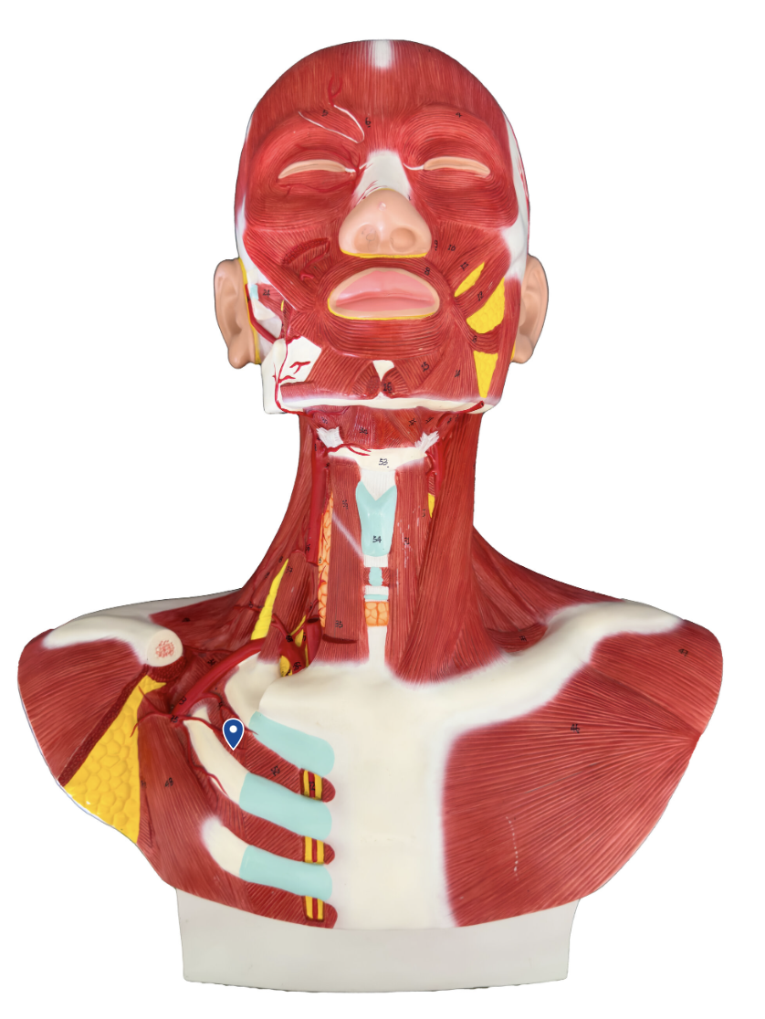 <p>What muscle is the arrow pointing to?</p>