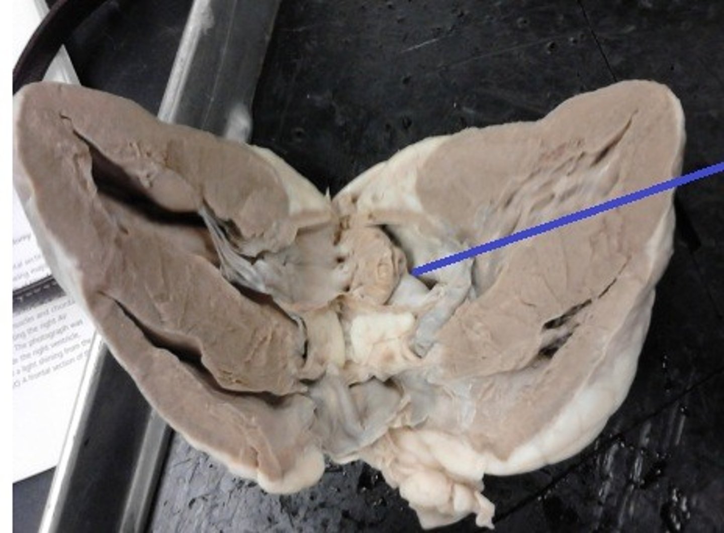 <p>Identify the valve.</p>