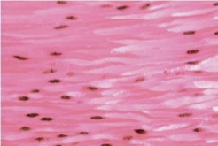 <p>What type of muscle is this?</p>