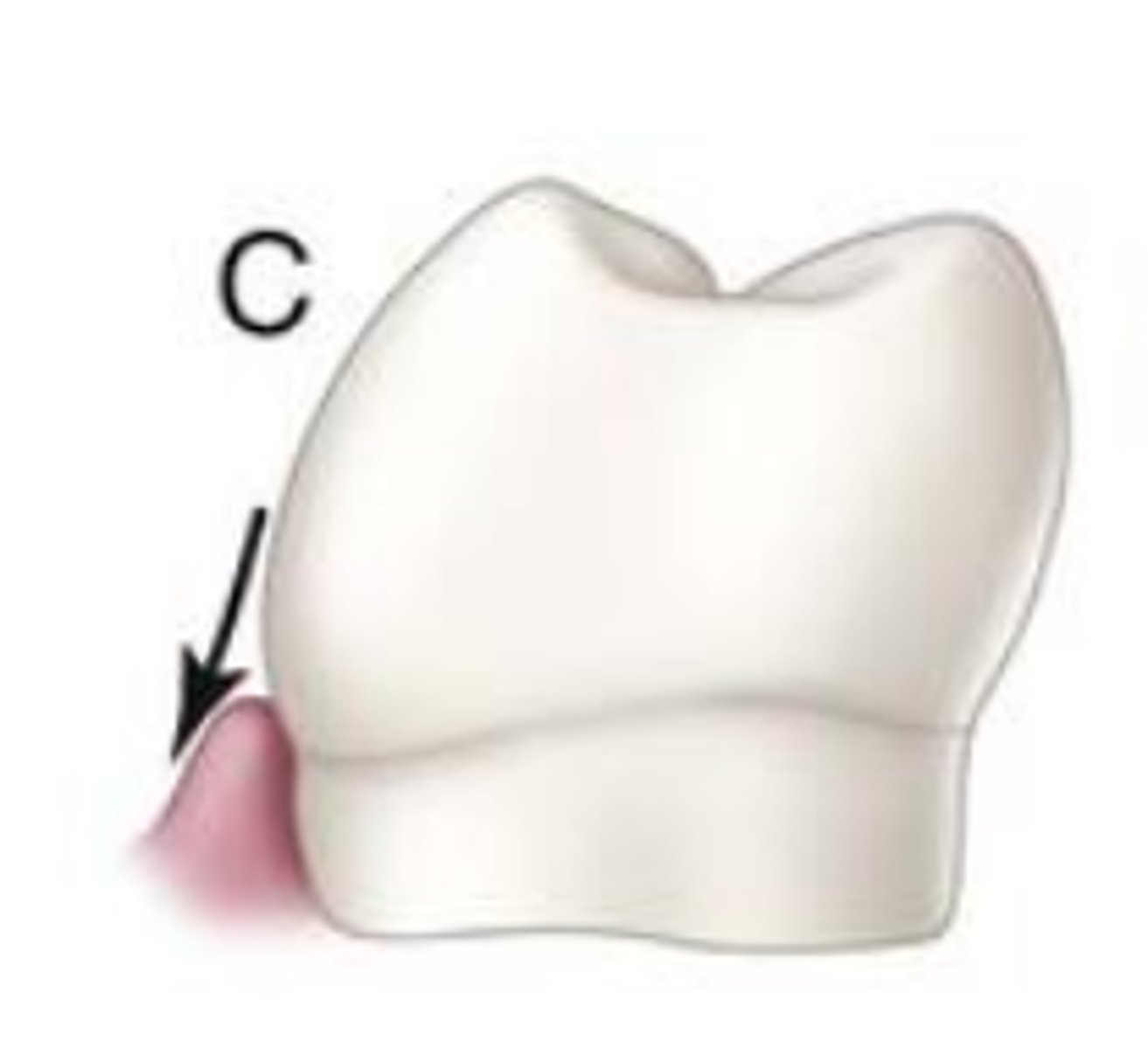 <p>Correct contours of a tooth permits...</p>