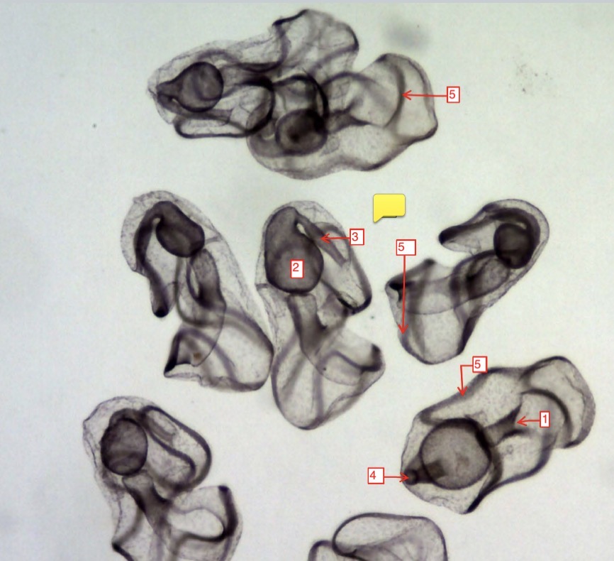 <p>starfish development stages late bipinnaria- (1)</p>