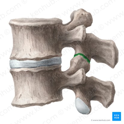 <p>The facet joint is this type of synovial joint</p>