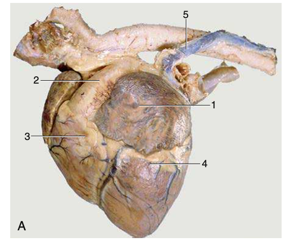 L heart, 1