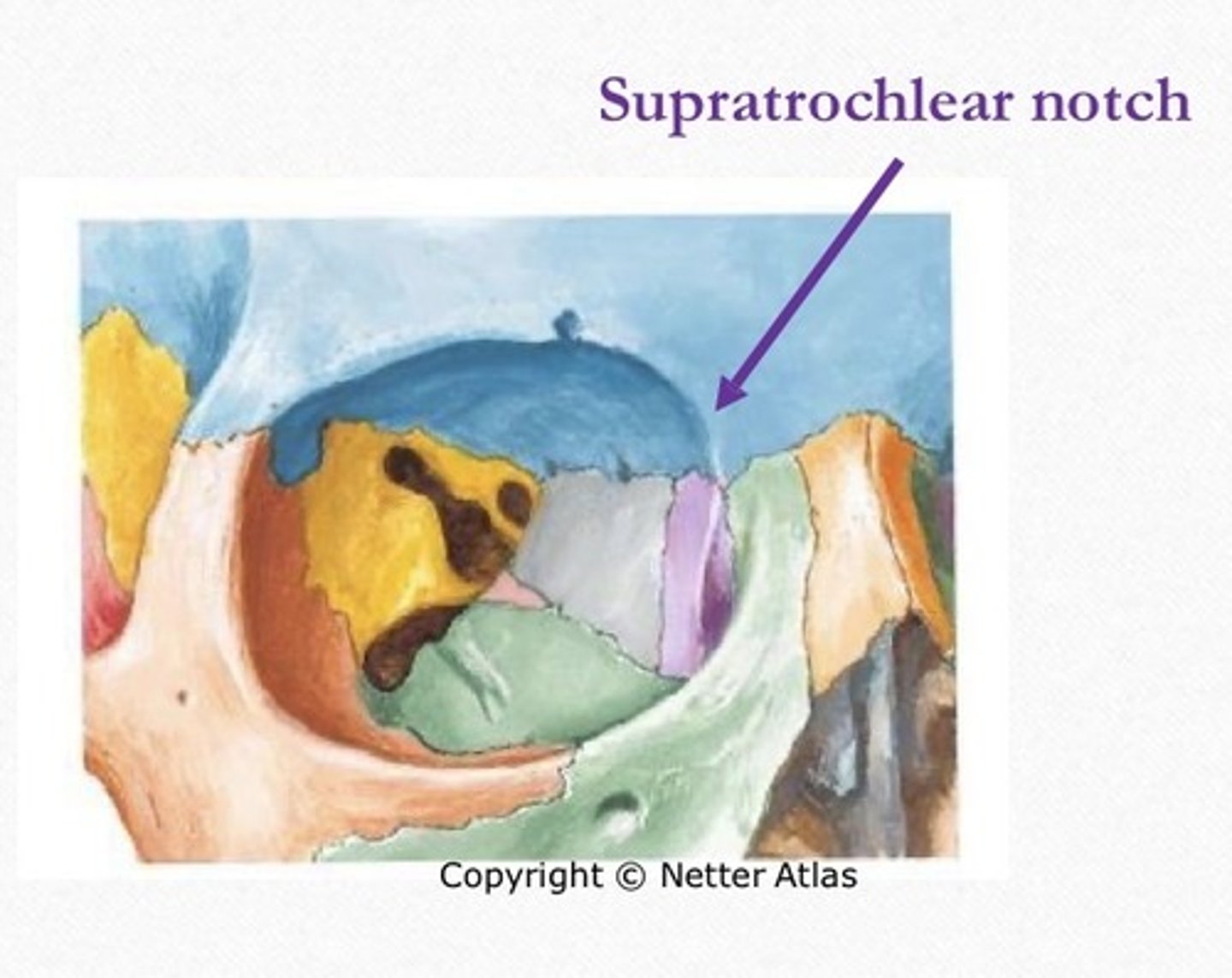 <p>Supratrochlear nerve, artery, and vein</p>
