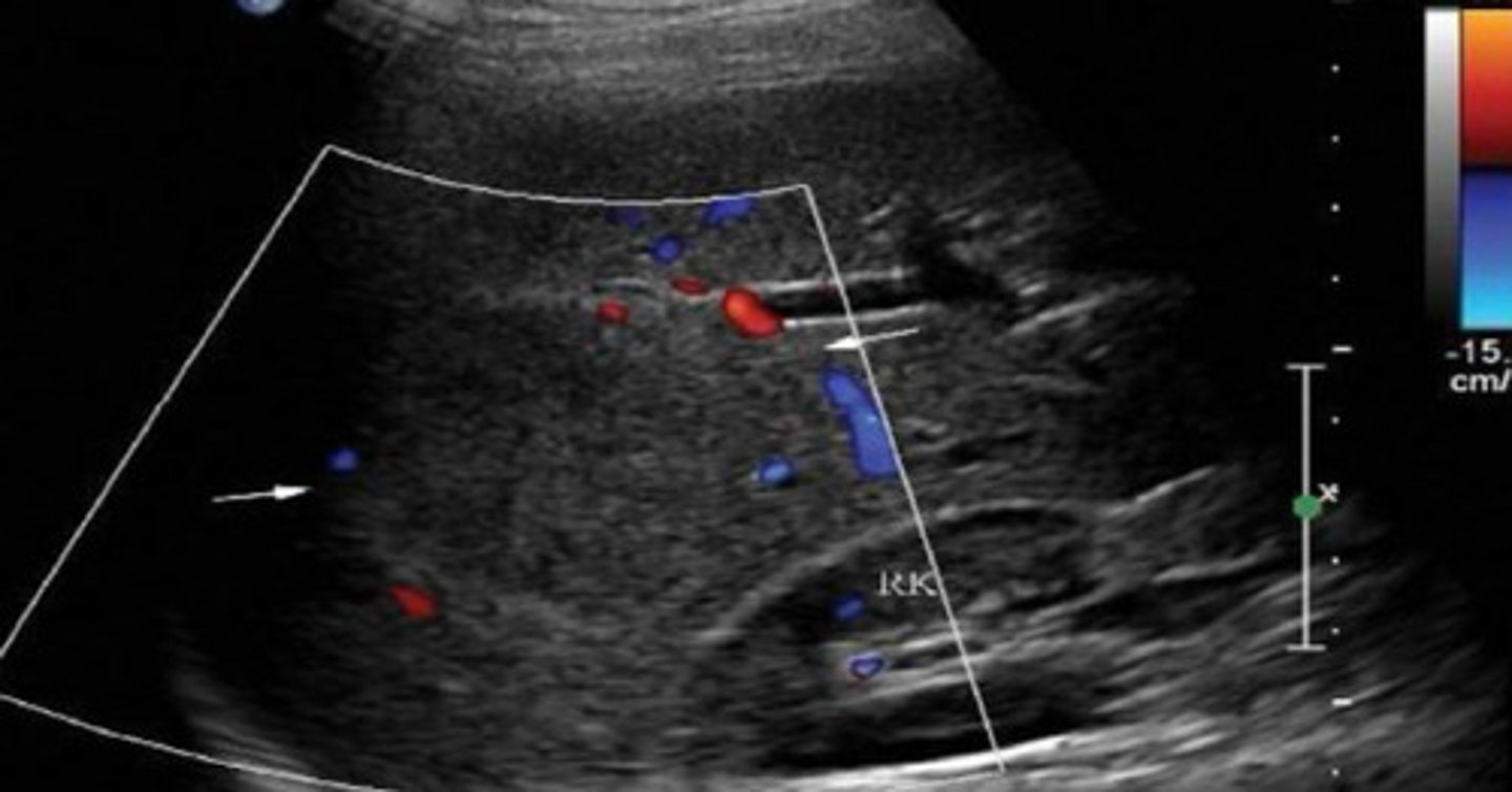 <p>What does this image show</p>