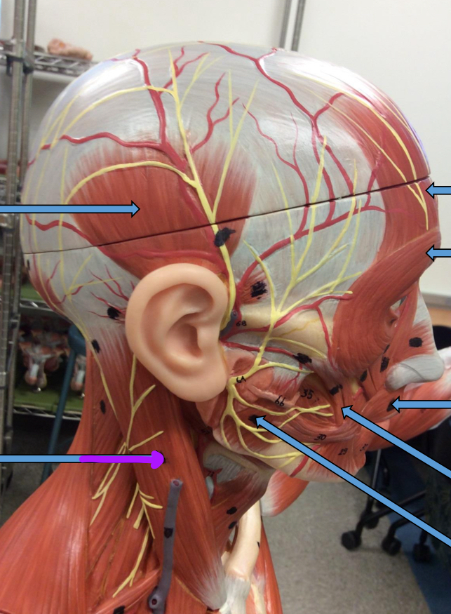 <p>Identify this muscle?</p>