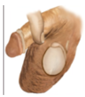 <p>The‬ absence of at least one‬ testicle from the scrotum</p>