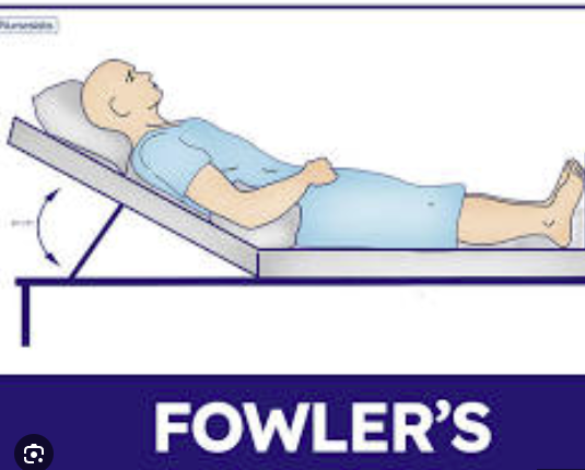 <p><span><span>a semiprone position where a patient lies on their left side with their right knee and thigh drawn up, and the left arm extended back</span></span></p>