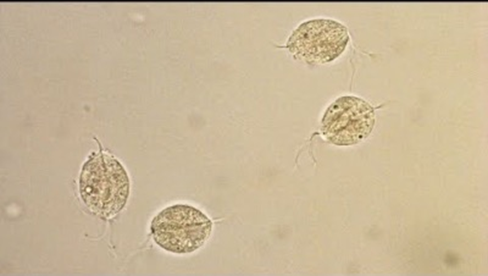 <p>HPF</p>