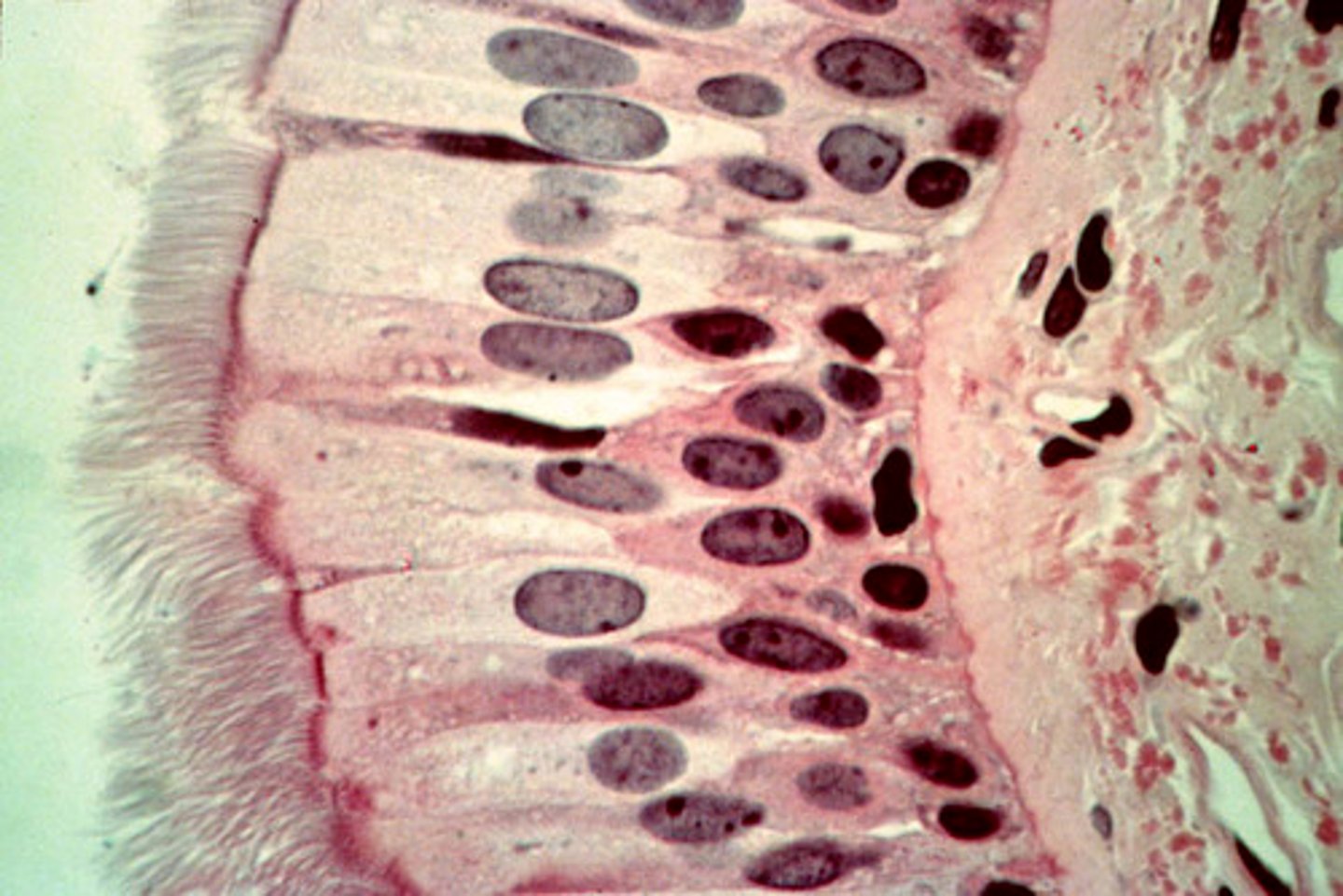 <p>Looks stratified, but all cells arise from basement membrane, nuclei at different heights, often ciliated</p><p>one layer. taller than wide, nuclei at different levels - all cells are attached to basal membrane</p><p>mucus-secreting goblet cells</p><p>location: lines respiratory airways, part of male urethra, epididymus</p><p>cilia towards lumen - pseudostratified columnar ciliated epithelium (PCCE)</p><p>function: secretion of mucus, trapping of dust particles, protection to lungs</p>