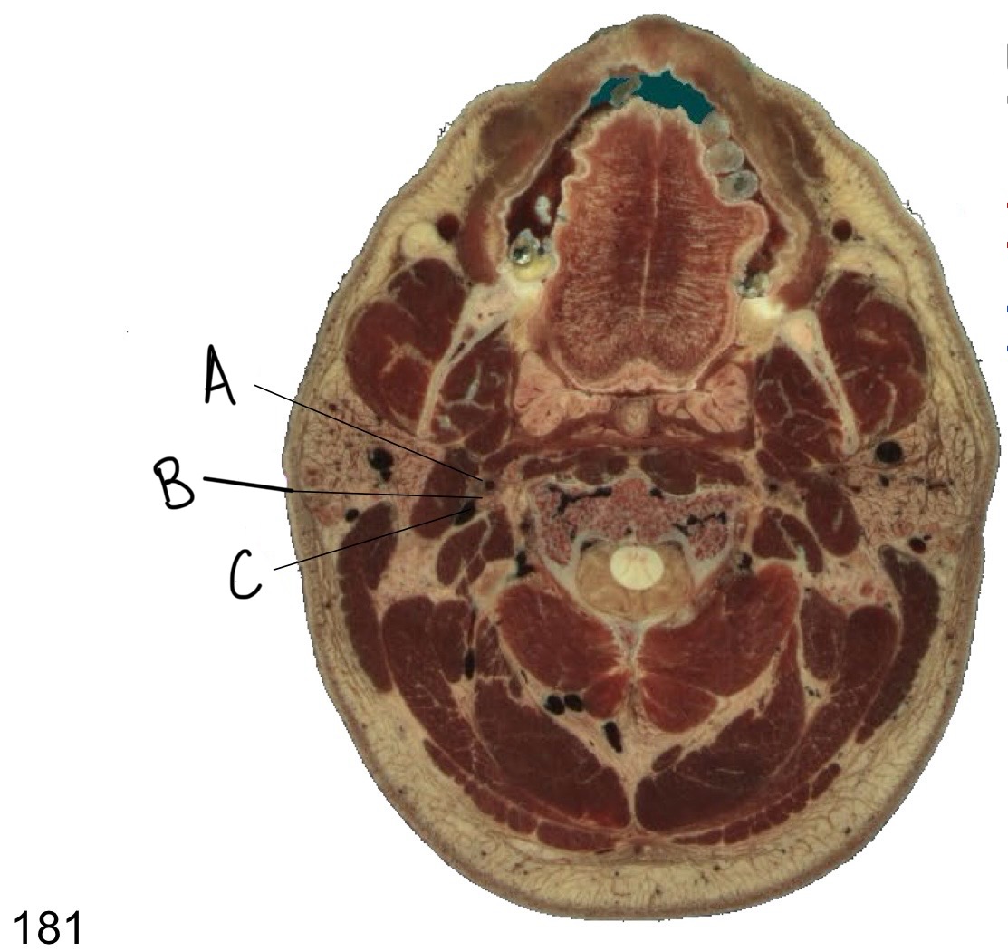<p>what structure is labeled A?</p>