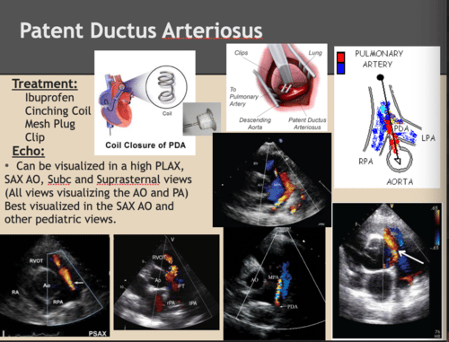 <p>echocardiogram</p>