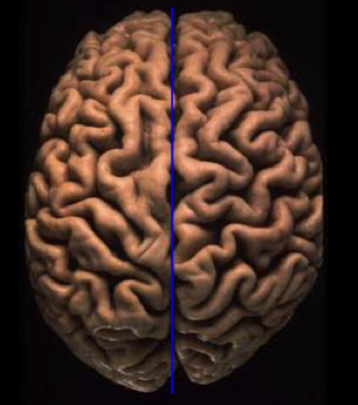 <p>What sulcus fissure/sulcus is this?</p>