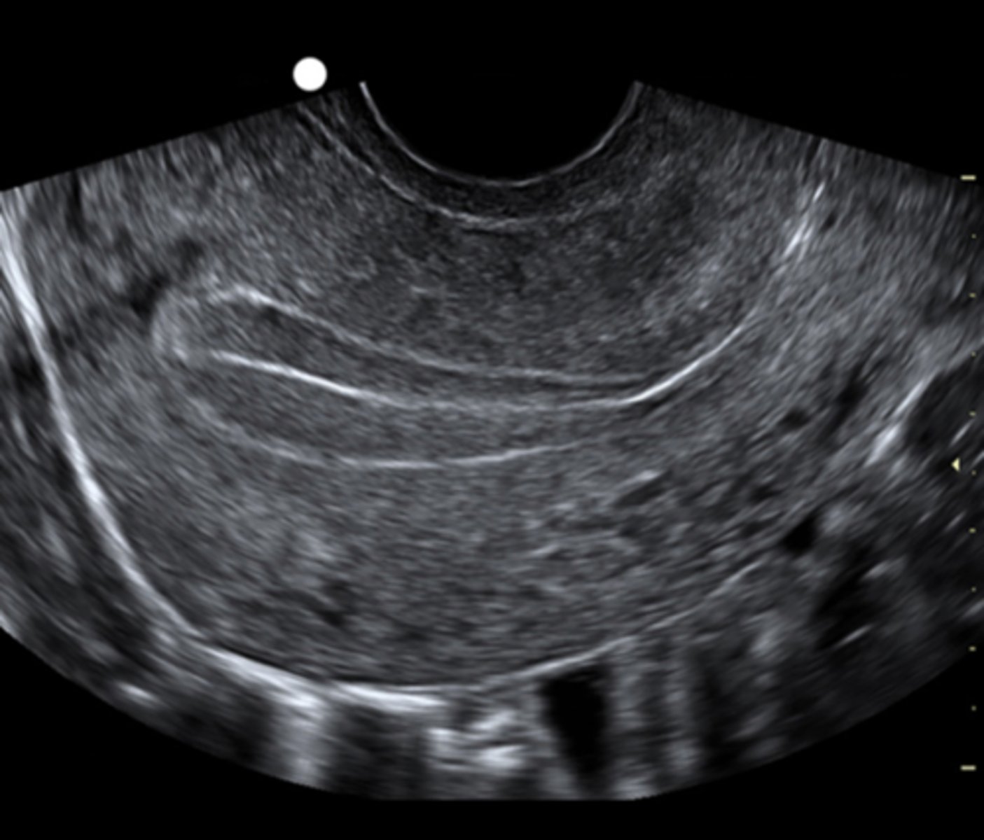 <p>what phase of endo cycle</p>