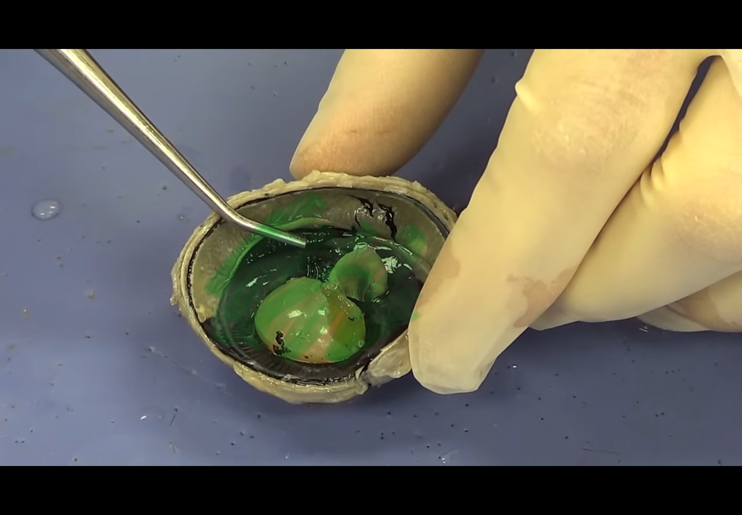 <p>From the lens back </p>