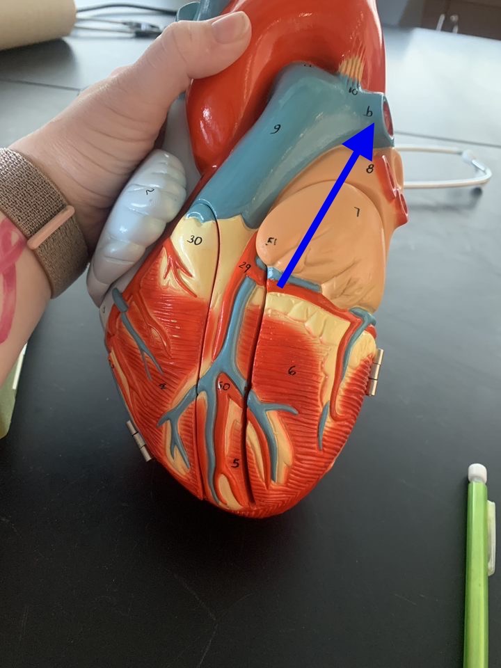 Name the heart structure.
