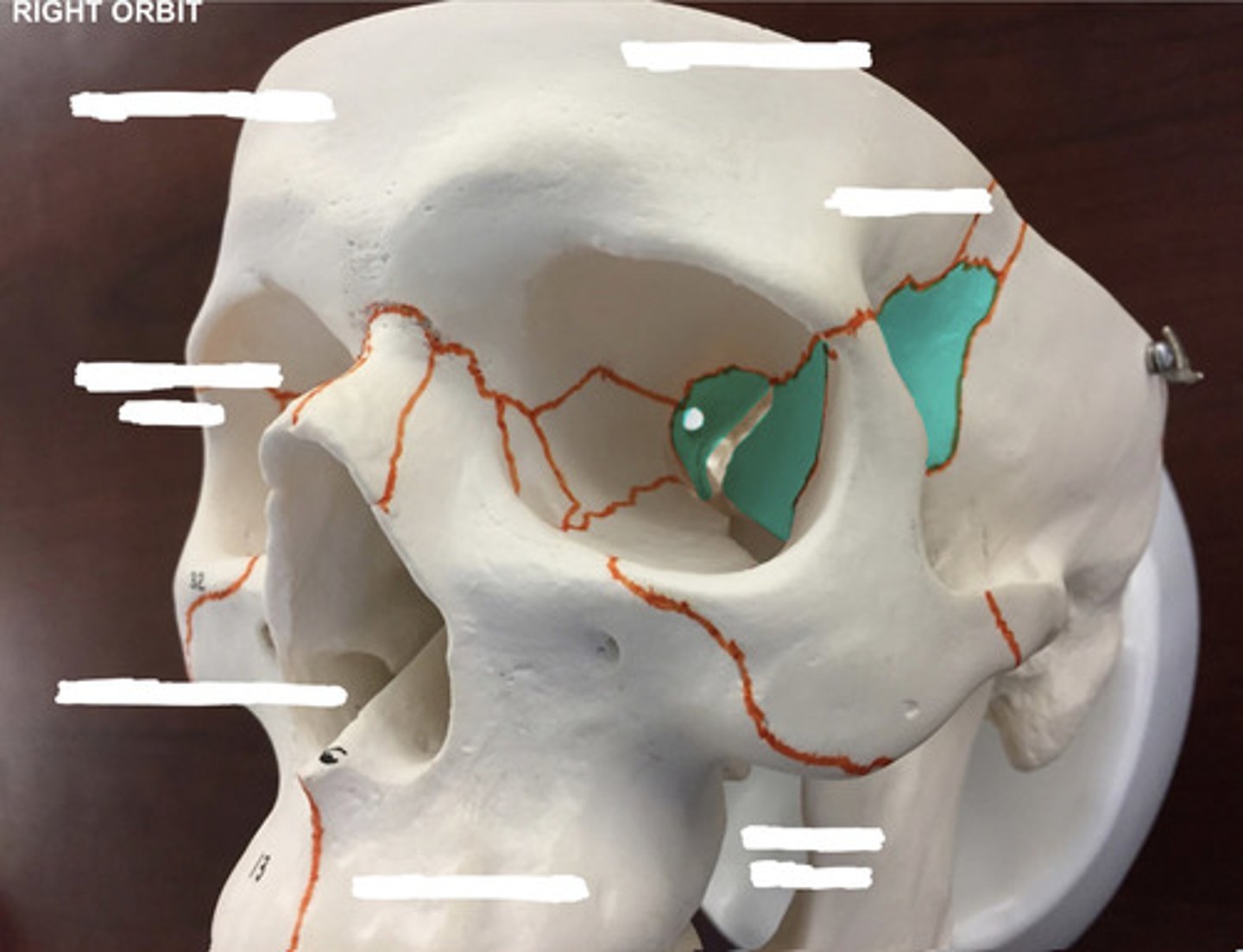 <p>What bone is highlighted here?</p>