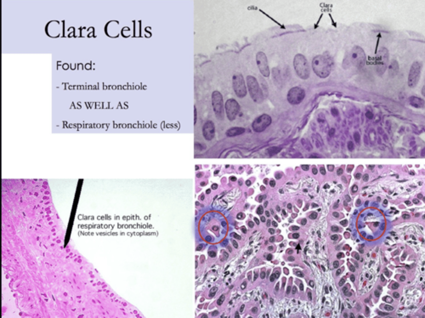 <p>dome shaped. It’s difficult to mobilize surfactant, so in order to release it, the Clara cells release their whole apical region (apocrine secretions).</p>