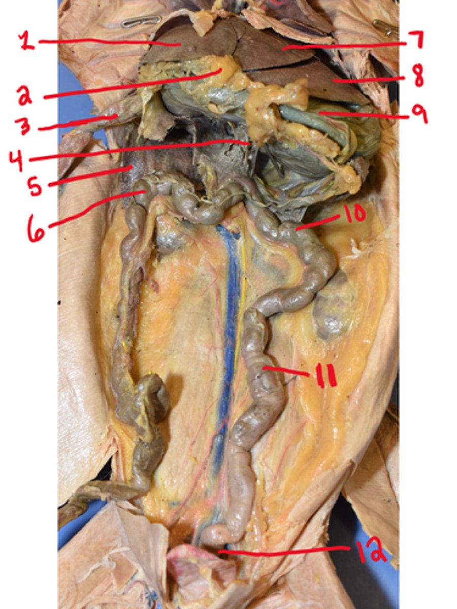 <p>What is structure #2</p>