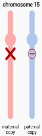 <p>chromosomal deletion on the maternal copy of chromosome 15</p><ul><li><p>symptoms: ataxia, uncontrolled laughing and smiling, seizures, minimal speech, etc.</p></li></ul><p></p>