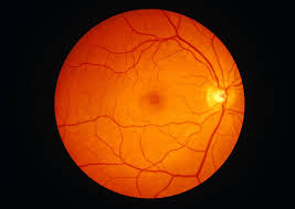 <p>The <strong><em></strong></em>__ is the light-sensitive layer of tissue at the back of the eye that converts light into neural signals for vision.</p>