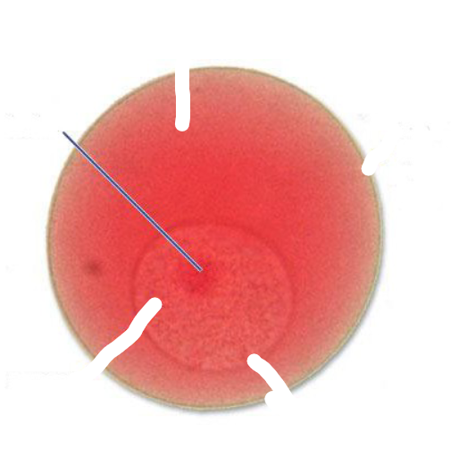 <p>What part of a starfish egg is this?</p>
