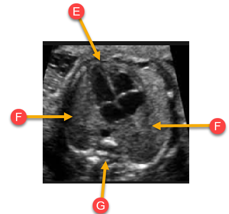 <p>Label the anatomy with the arrows</p>