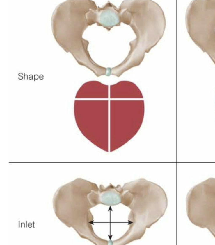 <p>Most favorable pelvis for childbirth; <strong>round or transverse oval shape</strong> and adequate diameters</p><ul><li><p><strong>favorable for vaginal birth</strong></p></li></ul><p></p>