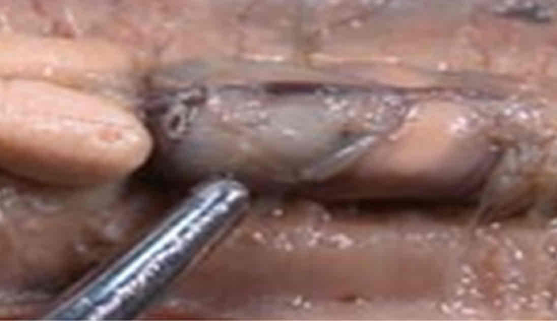 <p>Identify this structure</p>