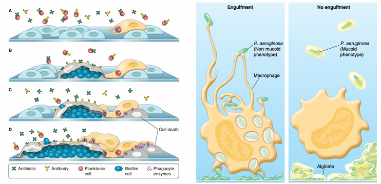 <p>Luchtwegen met gezonde epitheelcellen (lichtblauw) en alveolaire macrofaag (geel)</p><ul><li><p class="MsoListParagraphCxSpMiddle">Rood bolletje: planktonische cel →opgegeten door macrofaag</p></li><li><p class="MsoListParagraphCxSpMiddle">Blauw: biofilmcellen met matrix er rond</p></li><li><p class="MsoListParagraphCxSpMiddle">Macrofaag voelt dat er bact zitten dus gaat radicalen en enzymes aanmaken →maakt zich klaar om bact dood te maken MAAR kan er niet door</p></li><li><p class="MsoListParagraphCxSpMiddle">Radicalen vrijkomen en reageren met eigen cellen = gefrustreerde fagocytose</p></li></ul><p></p>