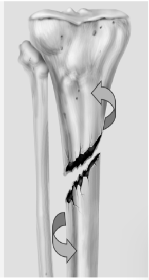term image