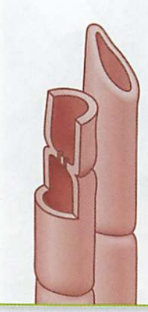 <ul><li><p>Xylem cells grow and form long straw-like tubes. The cells die but their thick cell wall remains.</p><ul><li><p>Xylem cells are dead, hollow, and connected to form a straw that water can pass through.</p><p></p></li></ul></li><li><p>Root cells absorb minerals from the soil and pass them to the xylem.</p></li><li><p>Water diffuses into the xylem by osmosis.</p></li><li><p>Pressure in the xylem builds and forces water upward.</p></li><li><p>One-way transport to leaves</p><ul><li><p>Ends at leaves</p></li></ul></li></ul><p></p>