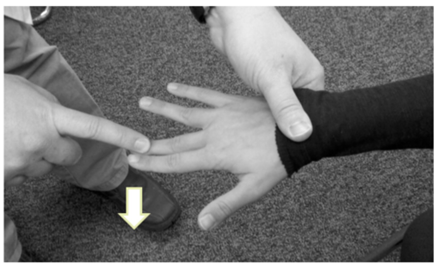 <p>resisted 3rd digit extension (distal to PIP)</p>