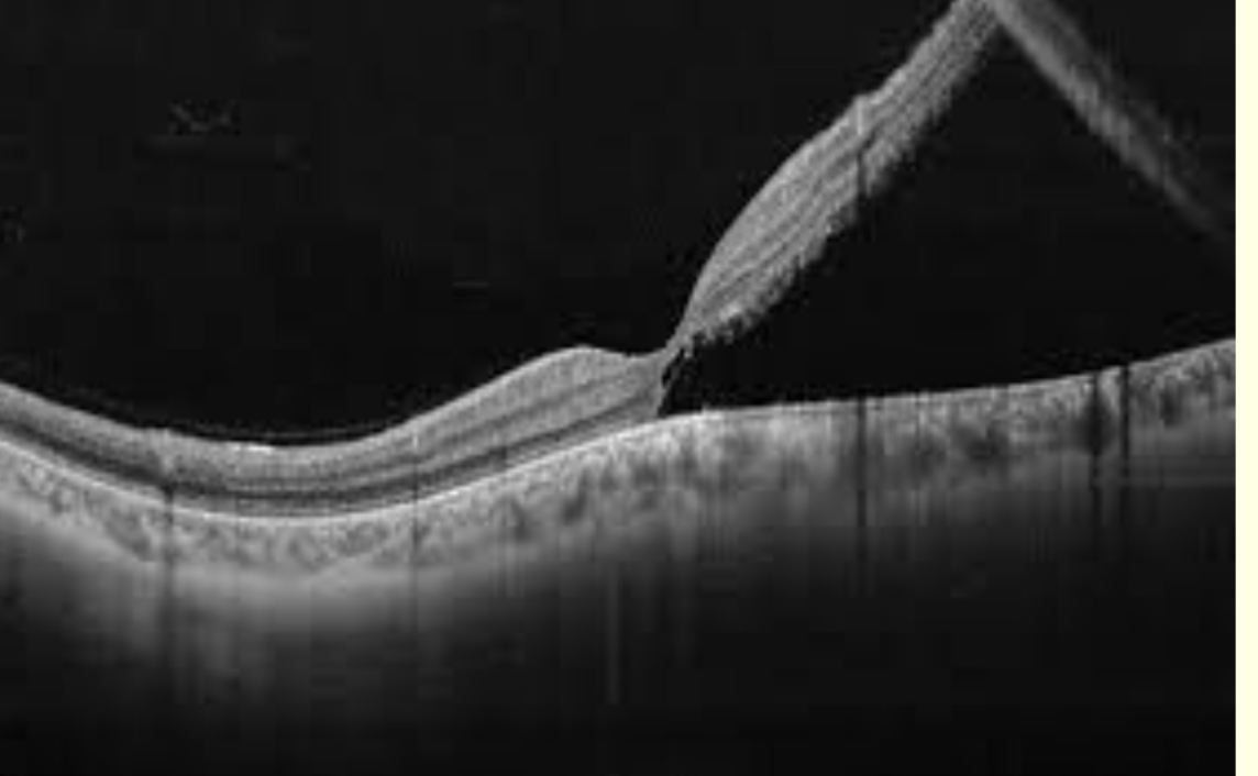 <p>What is this?</p>