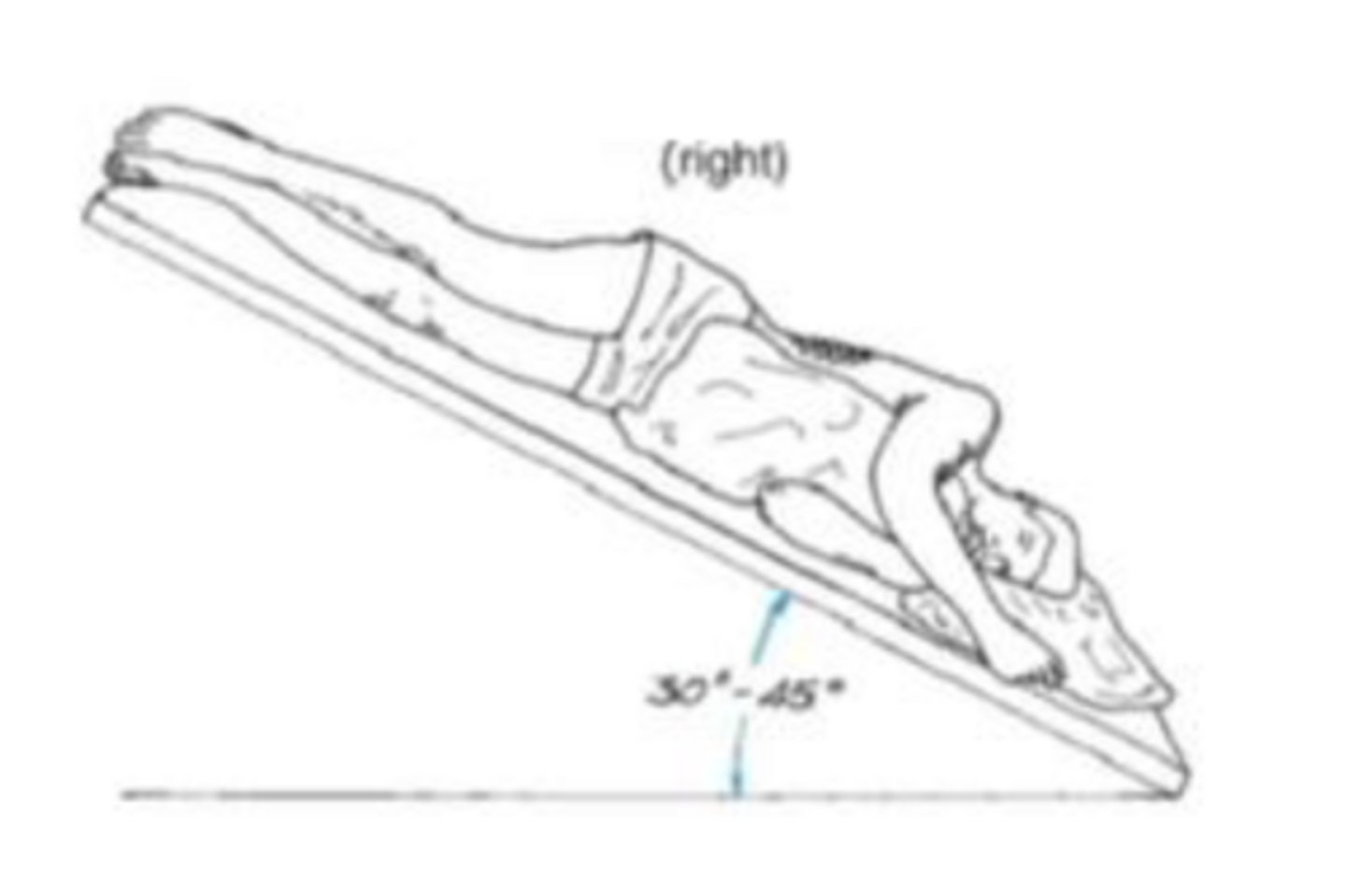 <p>patient lies on left side, in a 45 degree head-down position; percussion is applied over the lower lateral aspect of the right rib cage</p>