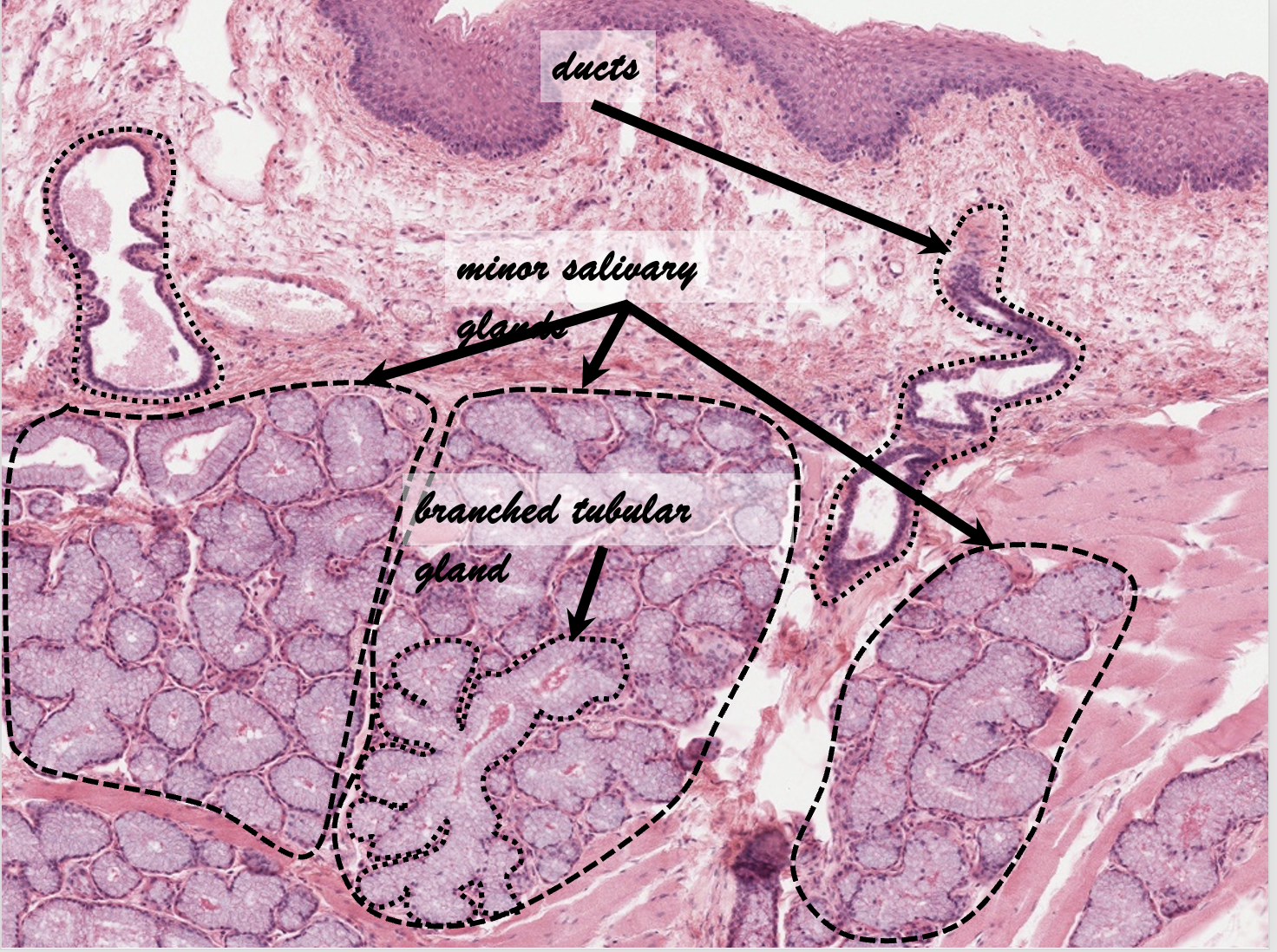<ul><li><p>No muscularis externa</p></li><li><p>No serosa/adventitia</p></li><li><p>Mucosa</p><ul><li><p>Non-keratinized stratified squamous epithelium</p></li><li><p>Lamina propria</p></li><li><p>No muscularis mucosae</p></li></ul></li><li><p>Submucosa</p><ul><li><p>Minor salivary glands</p><ul><li><p>Intrinsic glands</p></li><li><p>Mucus-secreting</p></li></ul></li></ul></li></ul>