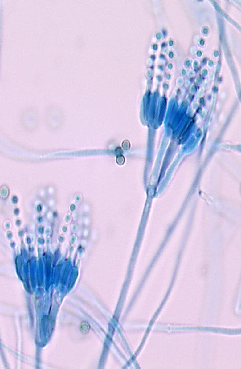 <p>Penicillium spp. produce clusters of thick phialides bearing chains of round conidia.</p>